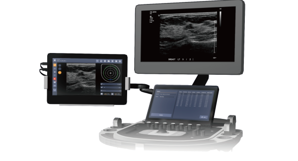 AI Radiology Assistant & Diagnosis Systems